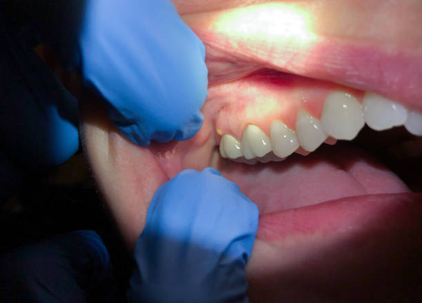 Best After-Hours Emergency Dentist in Scow Mills, MO